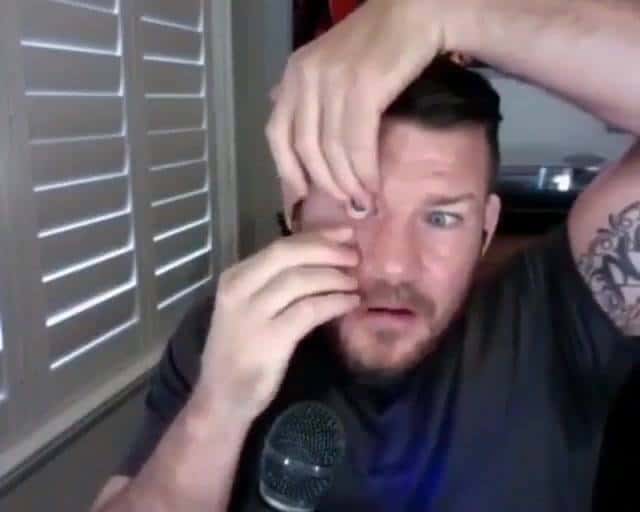 Former UFC champion Michael Bisping shocks viewers as he pops out fake EYEBALL on